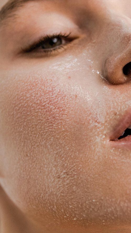 Dry vs. Dehydrated Skin: How to Actually Tell the Difference