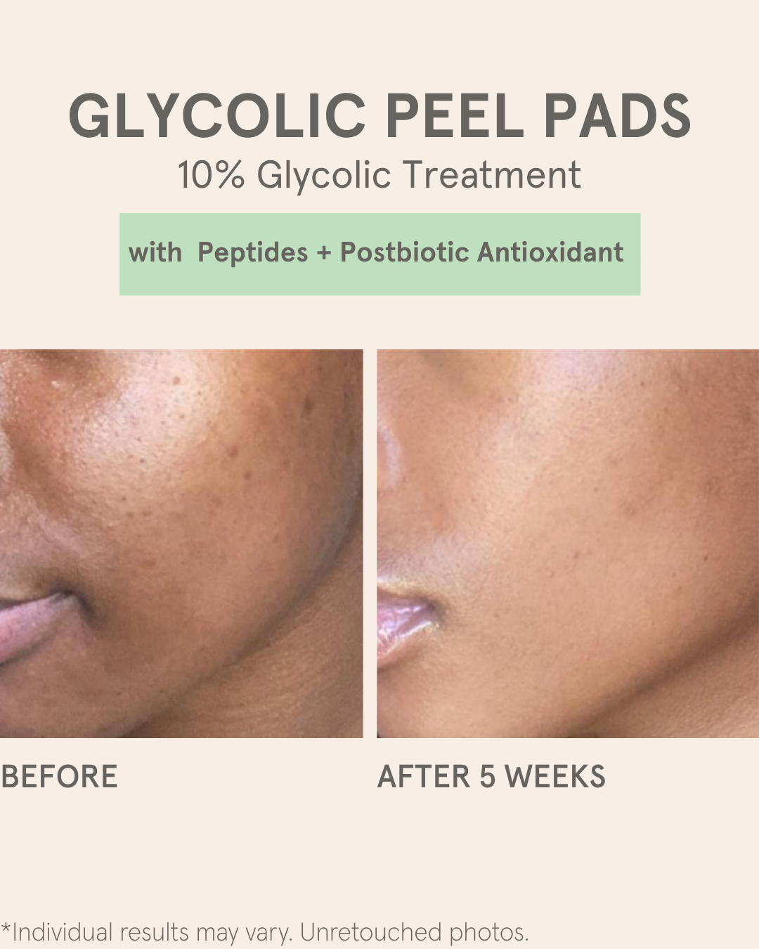 GLYCOLIC PEEL PADS