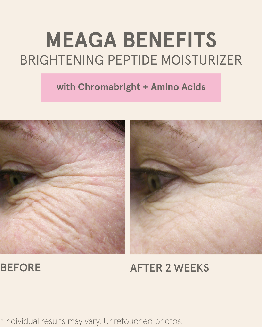 MEAGA BENEFITS