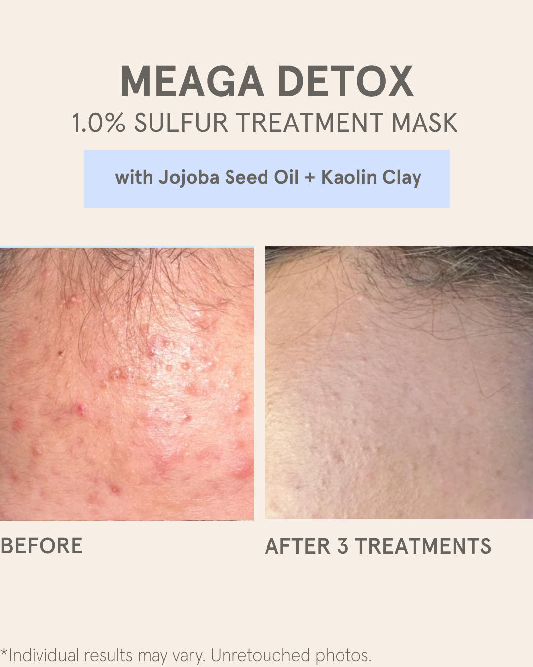 MEAGA DETOX