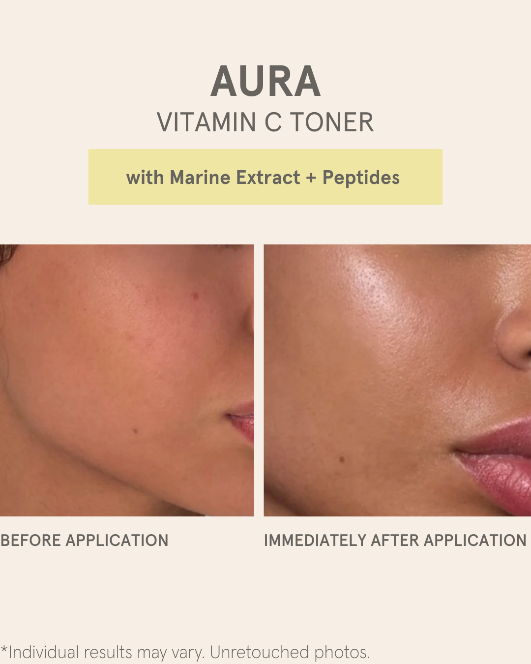 AURA