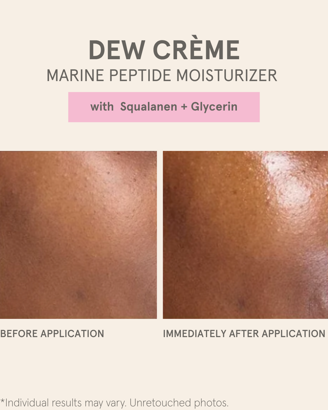 DEW CRÈME