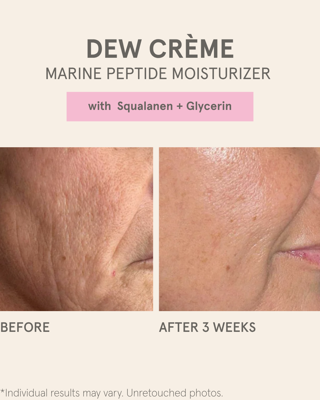 DEW CRÈME