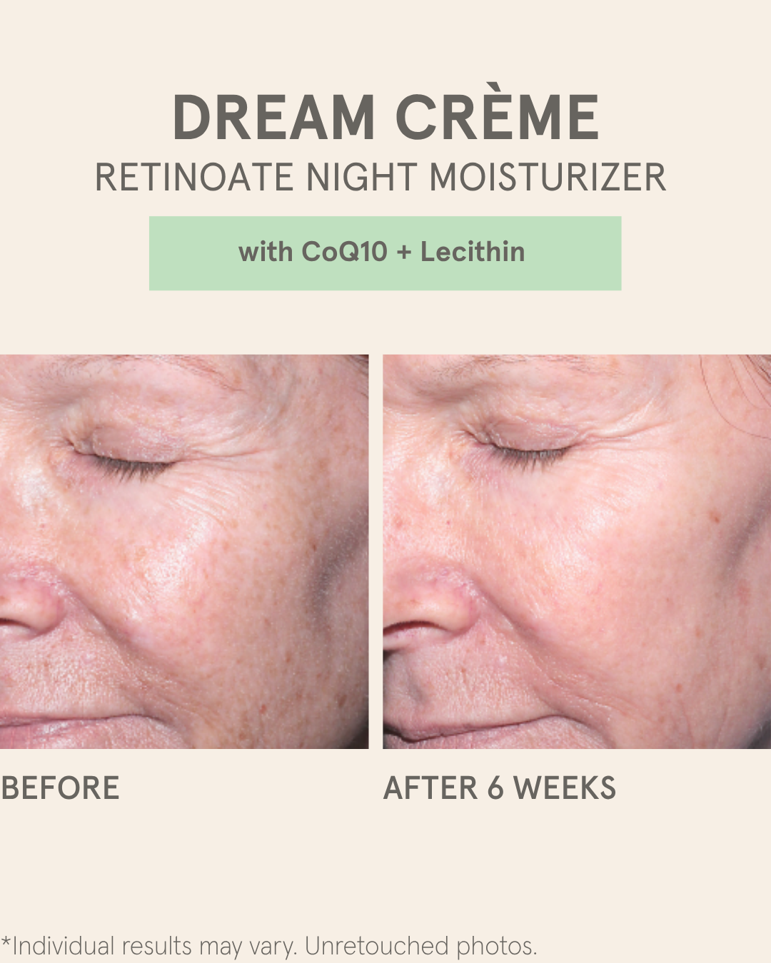 DREAM CRÈME