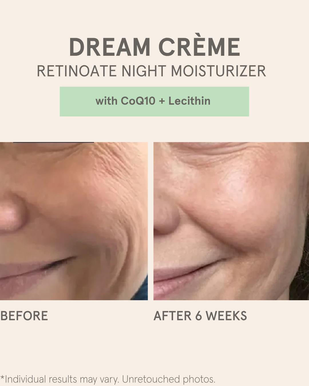 DREAM CRÈME