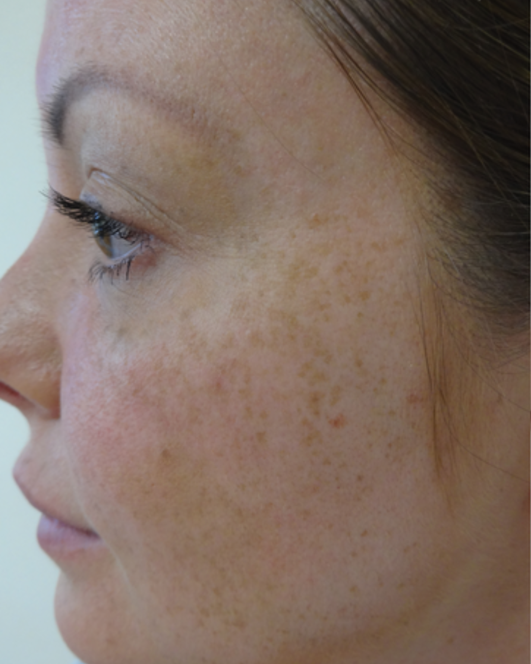 Before using Meaga Glow