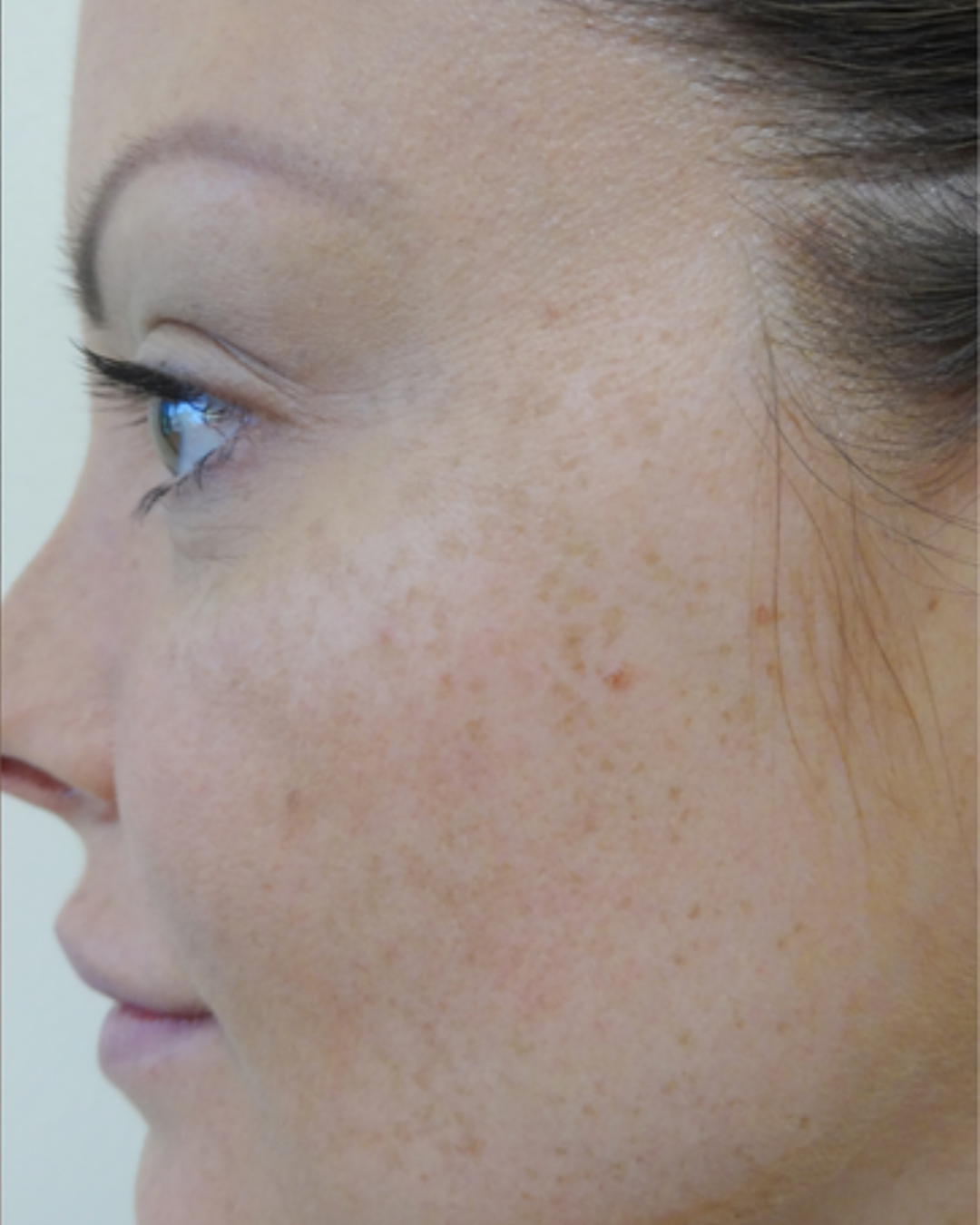 After using Meaga Glow