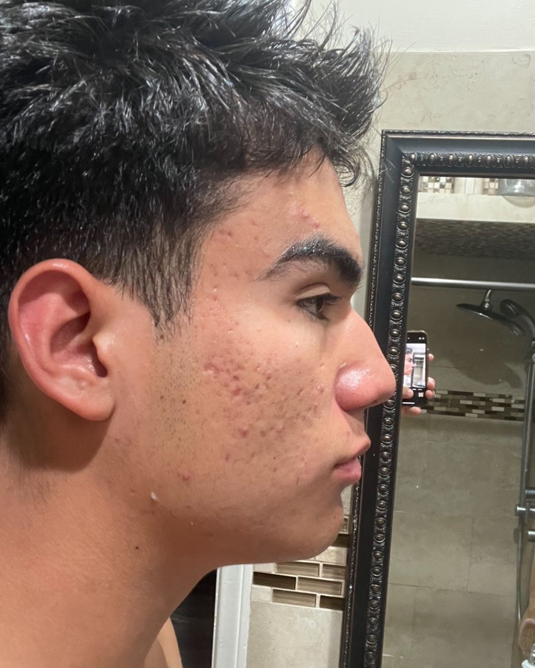 After using Meaga Glow
