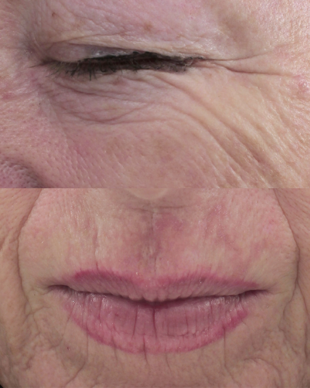 Before using Meaga Glow