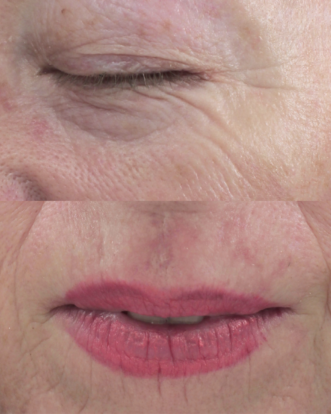 After using Meaga Glow